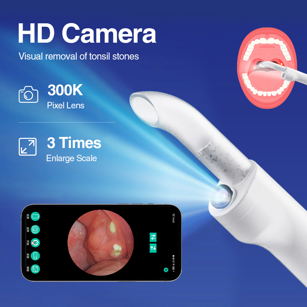 Smart Visual Tonsil Stone Remo - огляд і ціна Lighting Visual