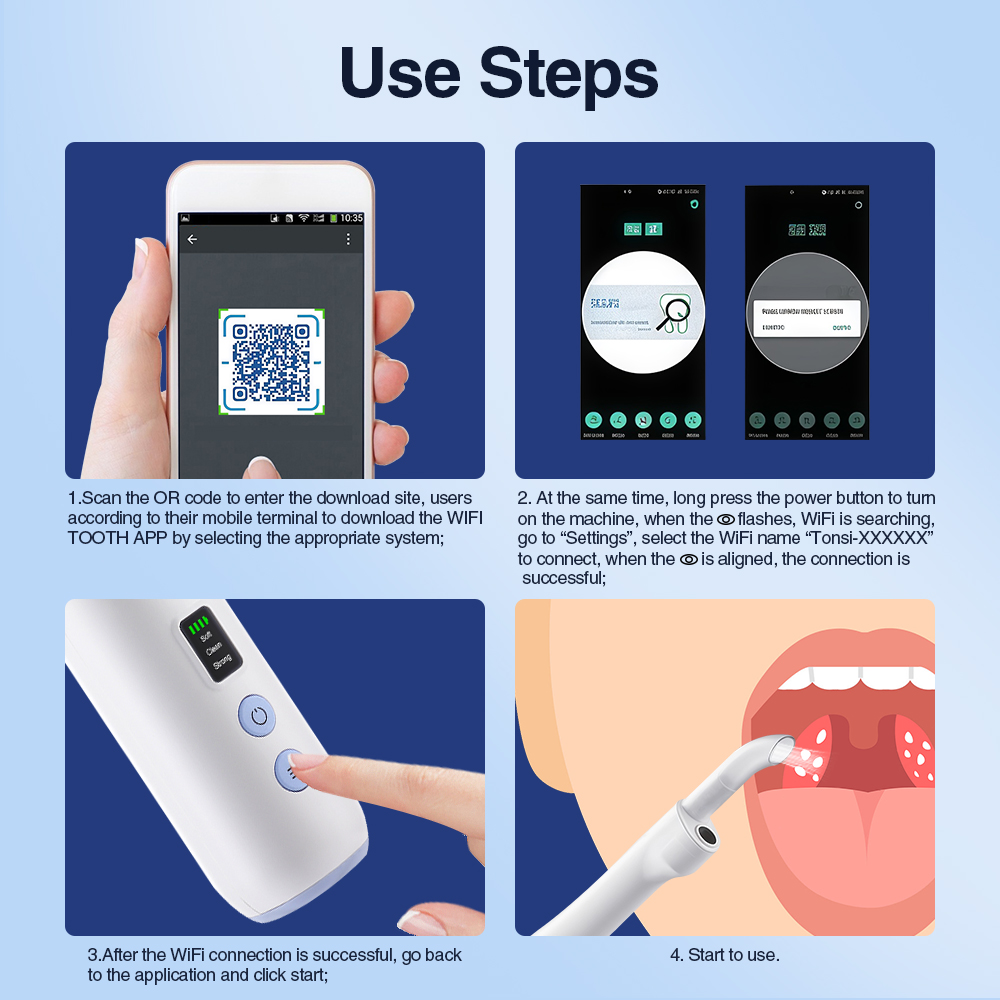 Smart Visual Tonsil Stone Remo - огляд і ціна Lighting Visual