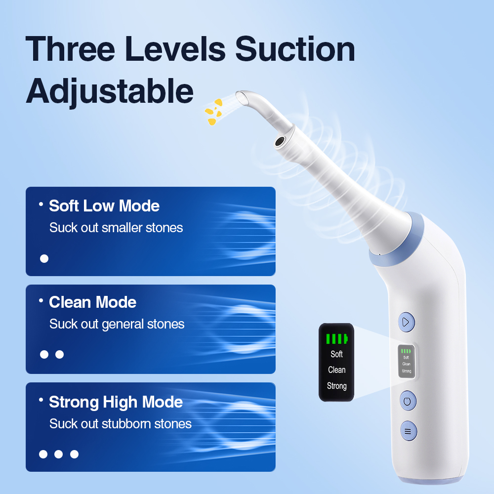 Smart Visual Tonsil Stone Remo - огляд і ціна Lighting Visual